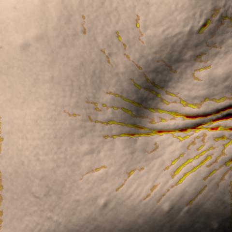 Antera 3D image of crow’s feet, baseline