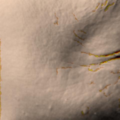 Antera 3D image of crow’s feet, day 14