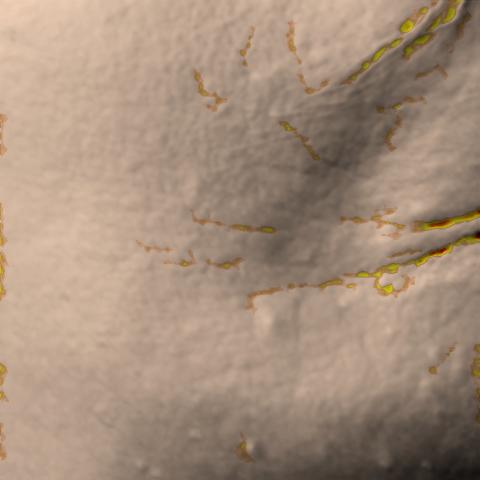 Antera 3D image of crow’s feet, day 28