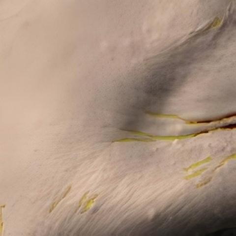 Antera 3D image of crow’s feet, day 42