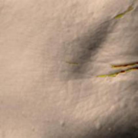 Antera 3D image of crow’s feet, day 56