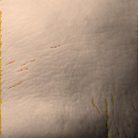 Antera 3D image of forehead lines, day 56
