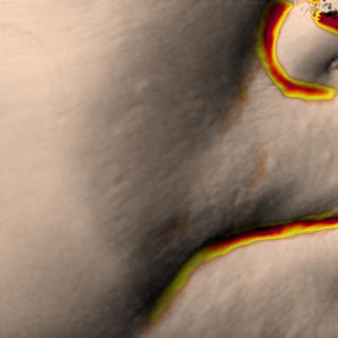 Antera 3D image of nasolabial folds, day 28
