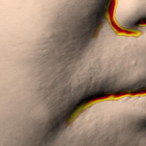 Antera 3D image of nasolabial folds, day 56