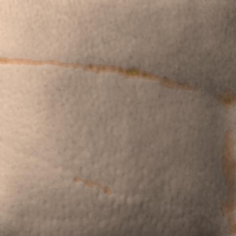 Antera 3D image of neck lines, baseline