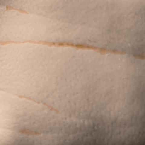 Antera 3D image of neck lines, day 14