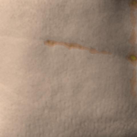 Antera 3D image of neck lines, day 28