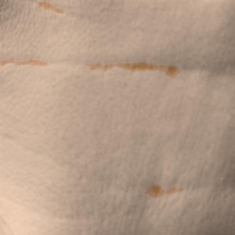 Antera 3D image of neck lines, day 42